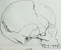 An illustration from Zur Morphologie der Rassen-Schädel : einleitende Bemerkungen und Beiträge, ein Sendschreiben an ... Carl Ernst v. Baer / von Joh. Christ. Gustav Lucae. (1861)