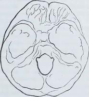 Picture 9 of 72 from Zur Morphologie der Rassen-Schädel : einleitende Bemerkungen und Beiträge, ein Sendschreiben an ... Carl Ernst v. Baer / von Joh. Christ. Gustav Lucae. (1861), leaf 57