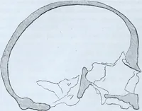 Picture 13 of 72 from Zur Morphologie der Rassen-Schädel : einleitende Bemerkungen und Beiträge, ein Sendschreiben an ... Carl Ernst v. Baer / von Joh. Christ. Gustav Lucae. (1861), leaf 78