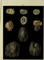An illustration from Graphic illustrations of abortion and the diseases of menstruation / Consisting of twelve plates from drawings engraved on stone, and coloured by Mr. J. Perry, and two copper-plates from the Philosophical transactions coloured by the same artist : the whole representing forty-five specimens of aborted ova and adventitious productions of the uterus : with preliminary observations, explanations of the figures, and remarks, anatomical and physiological. By A. B. Granville. (1833)