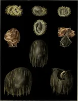 An illustration from Graphic illustrations of abortion and the diseases of menstruation / Consisting of twelve plates from drawings engraved on stone, and coloured by Mr. J. Perry, and two copper-plates from the Philosophical transactions coloured by the same artist : the whole representing forty-five specimens of aborted ova and adventitious productions of the uterus : with preliminary observations, explanations of the figures, and remarks, anatomical and physiological. By A. B. Granville. (1833)