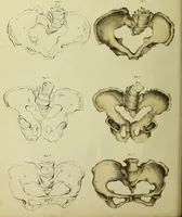 An illustration from Obstetric tables: comprising graphic illustrations, with descriptions and practical remarks; exhibiting on dissected plates many important subjects in midwifery. / By G. Spratt, surgeon-accoucheur. (1843)