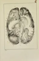 An illustration from Nuevo manual de frenolojía, escrito en inglés ... / puesto en francés con numerosas notas por el Doctor J. Fossati ... y traducido al español por Don José de Garaycoechea. (1840)