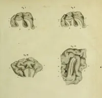 An illustration from Recherches sur le système nerveux en général, et sur celui du cerveau en particulier; mémoire présenté à l'Institut de France, le 14 mars 1808; suivi d'observations sur le rapport qui en a été faite à cette compagnie par ses commissaires / Par F.J. Gall et G. Spurzheim. (1809)