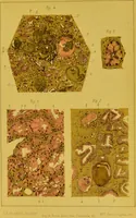 An illustration from Étude du processus histologique des néphrites / par Ch. Hortolès ; avec quatre gravures dans le texte et cinq planches chromolithographiées par M. Gouget. (1881)