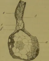An illustration from Étude du processus histologique des néphrites / par Ch. Hortolès ; avec quatre gravures dans le texte et cinq planches chromolithographiées par M. Gouget. (1881)