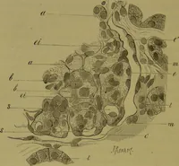 An illustration from Étude du processus histologique des néphrites / par Ch. Hortolès ; avec quatre gravures dans le texte et cinq planches chromolithographiées par M. Gouget. (1881)