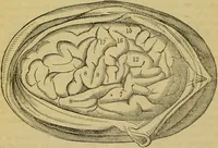 An illustration from Remarks on Dr. Elliotson's strictures on Spurzheim / by Henry Haley Holm. (1838)