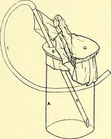 Picture 17 of 23 from Report on the bacteriological diagnosis and the antitoxic serum treatment of cases admitted to the hospitals of the Board during the years 1895 and 1896. / By G. Sims Woodhead. (1899), leaf 145