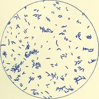 An illustration from Report on the bacteriological diagnosis and the antitoxic serum treatment of cases admitted to the hospitals of the Board during the years 1895 and 1896. / By G. Sims Woodhead. (1899)