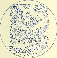 An illustration from Report on the bacteriological diagnosis and the antitoxic serum treatment of cases admitted to the hospitals of the Board during the years 1895 and 1896. / By G. Sims Woodhead. (1899)
