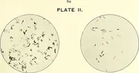 An illustration from Report on the bacteriological diagnosis and the antitoxic serum treatment of cases admitted to the hospitals of the Board during the years 1895 and 1896. / By G. Sims Woodhead. (1899)