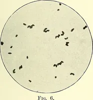 An illustration from Report on the bacteriological diagnosis and the antitoxic serum treatment of cases admitted to the hospitals of the Board during the years 1895 and 1896. / By G. Sims Woodhead. (1899)