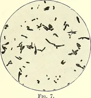 An illustration from Report on the bacteriological diagnosis and the antitoxic serum treatment of cases admitted to the hospitals of the Board during the years 1895 and 1896. / By G. Sims Woodhead. (1899)