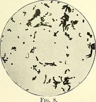 An illustration from Report on the bacteriological diagnosis and the antitoxic serum treatment of cases admitted to the hospitals of the Board during the years 1895 and 1896. / By G. Sims Woodhead. (1899)