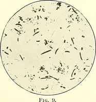 An illustration from Report on the bacteriological diagnosis and the antitoxic serum treatment of cases admitted to the hospitals of the Board during the years 1895 and 1896. / By G. Sims Woodhead. (1899)