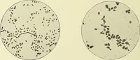 An illustration from Report on the bacteriological diagnosis and the antitoxic serum treatment of cases admitted to the hospitals of the Board during the years 1895 and 1896. / By G. Sims Woodhead. (1899)
