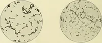 An illustration from Report on the bacteriological diagnosis and the antitoxic serum treatment of cases admitted to the hospitals of the Board during the years 1895 and 1896. / By G. Sims Woodhead. (1899)