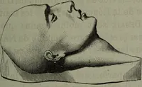 An illustration from La tête humaine : études de phrénologie et de physiognomonie appliquées aux personnages célèbres de l'antiquité et des temps modernes : avec 75 figures intercalées dans le texte / par Charles Rouvin. (1877)