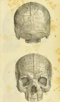 An illustration from Rejet de l'organologie phrénologique de Gall, et de ses successeurs / par F. Lélut. (1843)