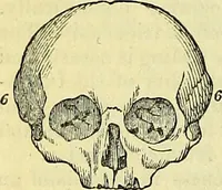 An illustration from Outlines of phrenology / by the late J.G. Spurzheim. (1844)