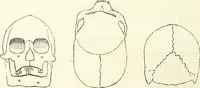 An illustration from Crania americana or, A comparative view of the skulls of various aboriginal nations of North and South America : to which is prefixed an essay on the varities of the human species / by Samuel George Morton. (1839)