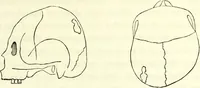 Picture 12 of 143 from Crania americana or, A comparative view of the skulls of various aboriginal nations of North and South America : to which is prefixed an essay on the varities of the human species / by Samuel George Morton. (1839), leaf 153