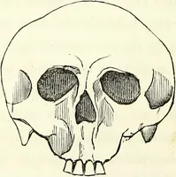 An illustration from Crania americana or, A comparative view of the skulls of various aboriginal nations of North and South America : to which is prefixed an essay on the varities of the human species / by Samuel George Morton. (1839)