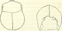 Picture 17 of 143 from Crania americana or, A comparative view of the skulls of various aboriginal nations of North and South America : to which is prefixed an essay on the varities of the human species / by Samuel George Morton. (1839), leaf 174