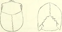 Picture 18 of 143 from Crania americana or, A comparative view of the skulls of various aboriginal nations of North and South America : to which is prefixed an essay on the varities of the human species / by Samuel George Morton. (1839), leaf 175