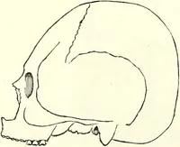 Picture 20 of 143 from Crania americana or, A comparative view of the skulls of various aboriginal nations of North and South America : to which is prefixed an essay on the varities of the human species / by Samuel George Morton. (1839), leaf 176