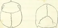 An illustration from Crania americana or, A comparative view of the skulls of various aboriginal nations of North and South America : to which is prefixed an essay on the varities of the human species / by Samuel George Morton. (1839)