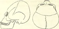 An illustration from Crania americana or, A comparative view of the skulls of various aboriginal nations of North and South America : to which is prefixed an essay on the varities of the human species / by Samuel George Morton. (1839)