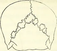 Picture 28 of 143 from Crania americana or, A comparative view of the skulls of various aboriginal nations of North and South America : to which is prefixed an essay on the varities of the human species / by Samuel George Morton. (1839), leaf 184