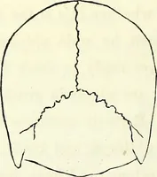 An illustration from Crania americana or, A comparative view of the skulls of various aboriginal nations of North and South America : to which is prefixed an essay on the varities of the human species / by Samuel George Morton. (1839)
