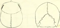 An illustration from Crania americana or, A comparative view of the skulls of various aboriginal nations of North and South America : to which is prefixed an essay on the varities of the human species / by Samuel George Morton. (1839)
