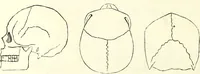 An illustration from Crania americana or, A comparative view of the skulls of various aboriginal nations of North and South America : to which is prefixed an essay on the varities of the human species / by Samuel George Morton. (1839)