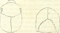 Picture 36 of 143 from Crania americana or, A comparative view of the skulls of various aboriginal nations of North and South America : to which is prefixed an essay on the varities of the human species / by Samuel George Morton. (1839), leaf 194