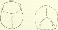 Picture 39 of 143 from Crania americana or, A comparative view of the skulls of various aboriginal nations of North and South America : to which is prefixed an essay on the varities of the human species / by Samuel George Morton. (1839), leaf 201