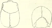 An illustration from Crania americana or, A comparative view of the skulls of various aboriginal nations of North and South America : to which is prefixed an essay on the varities of the human species / by Samuel George Morton. (1839)