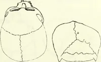 An illustration from Crania americana or, A comparative view of the skulls of various aboriginal nations of North and South America : to which is prefixed an essay on the varities of the human species / by Samuel George Morton. (1839)