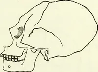 An illustration from Crania americana or, A comparative view of the skulls of various aboriginal nations of North and South America : to which is prefixed an essay on the varities of the human species / by Samuel George Morton. (1839)