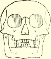 An illustration from Crania americana or, A comparative view of the skulls of various aboriginal nations of North and South America : to which is prefixed an essay on the varities of the human species / by Samuel George Morton. (1839)