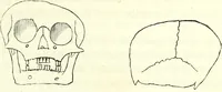 An illustration from Crania americana or, A comparative view of the skulls of various aboriginal nations of North and South America : to which is prefixed an essay on the varities of the human species / by Samuel George Morton. (1839)
