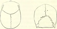 Picture 73 of 143 from Crania americana or, A comparative view of the skulls of various aboriginal nations of North and South America : to which is prefixed an essay on the varities of the human species / by Samuel George Morton. (1839), leaf 264