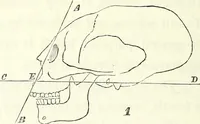 An illustration from Crania americana or, A comparative view of the skulls of various aboriginal nations of North and South America : to which is prefixed an essay on the varities of the human species / by Samuel George Morton. (1839)