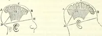An illustration from Crania americana or, A comparative view of the skulls of various aboriginal nations of North and South America : to which is prefixed an essay on the varities of the human species / by Samuel George Morton. (1839)