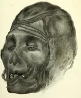 An illustration from Crania americana or, A comparative view of the skulls of various aboriginal nations of North and South America : to which is prefixed an essay on the varities of the human species / by Samuel George Morton. (1839)