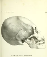 Picture 86 of 143 from Crania americana or, A comparative view of the skulls of various aboriginal nations of North and South America : to which is prefixed an essay on the varities of the human species / by Samuel George Morton. (1839), leaf 323