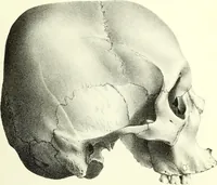 An illustration from Crania americana or, A comparative view of the skulls of various aboriginal nations of North and South America : to which is prefixed an essay on the varities of the human species / by Samuel George Morton. (1839)